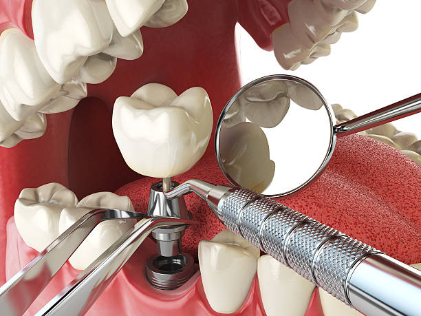 Best Emergency Dentist for Knocked-Out Tooth in Emerald Lakes, PA